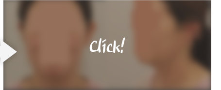 실루엣리프팅