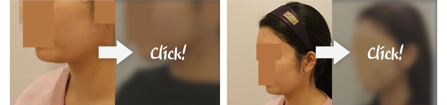 리얼후기