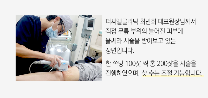 바디울쎄라