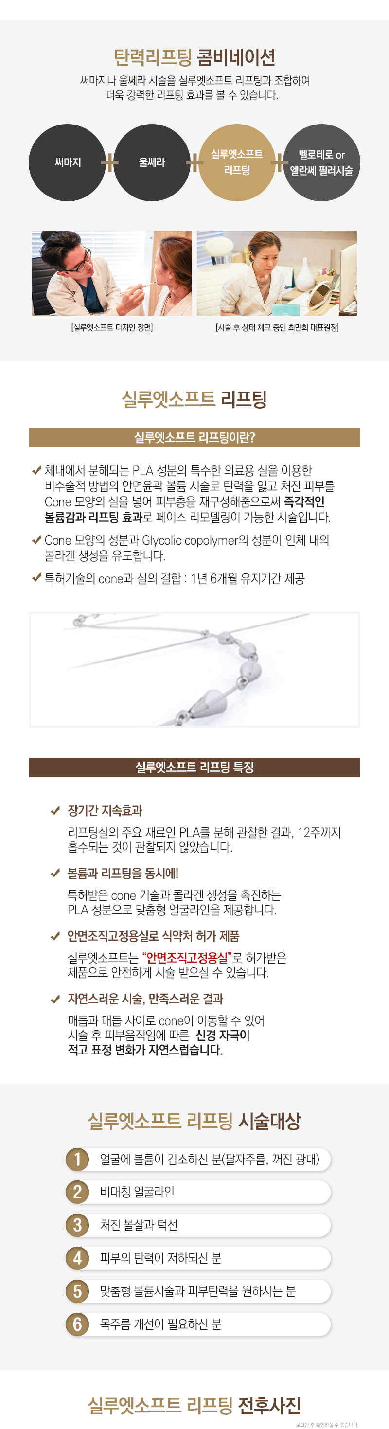 실루엣리프팅